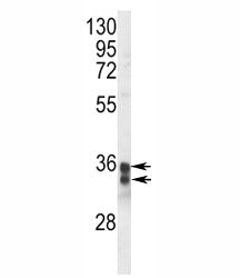 STING Antibody (TMEM173)