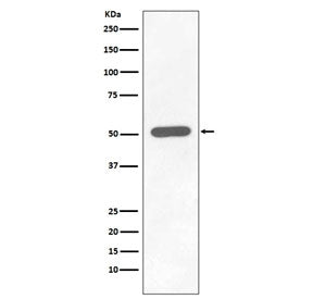Western blot testing of lysate from human HEK293 cells treated with Calyculin with phospho-Chk1 anti