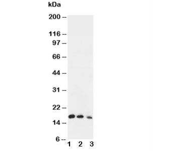 Western blot testing of IL7 antibody and Lane 1: Recombinant human IL-7 protein 10ng; 2: 5ng; 3: 2.5
