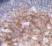 IHC staining of FFPE human tonsillitis tissue with MARCO antibody. HIER: steam section in pH6 citrat