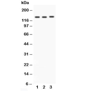 Western blot testing of Integrin alpha 1 antibody and Lane 1: rat brain; 2: HeLa; 3: SW620; Predicte