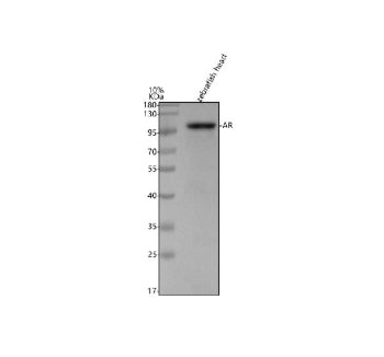 Western blot analysis of zebrafish Androgen receptor protein using Zebrafish Androgen receptor antib