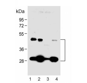 Western blot testing of human 1) A431, 2) MCF7, 3) K562 and 4) PANC-1 cell lysate with Cathepsin D a