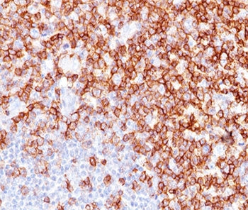 CD45RO Antibody (T-cell marker)