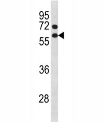 Cyclin B1 Antibody (CCNB1)