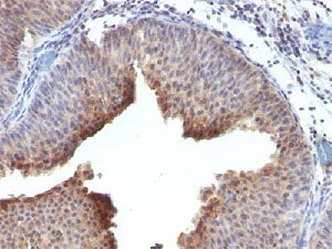 Keratin 6 Antibody / Cytokeratin 6