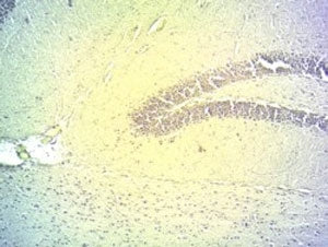IHC testing of PFA-fixed cryosectioned mouse hippocampus with DIO2 antibody at 2ug/ml. HIER: microwa