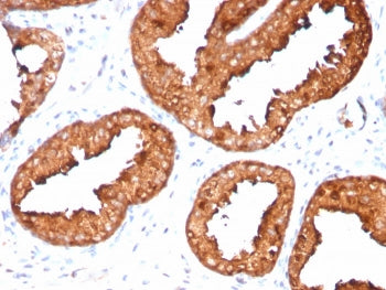 PSA / Prostate Specific Antigen Antibody