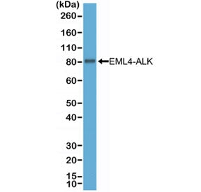Western blot testing of the non-small cell lung cancer cell line H2228 cell lysate expressing EML4-A
