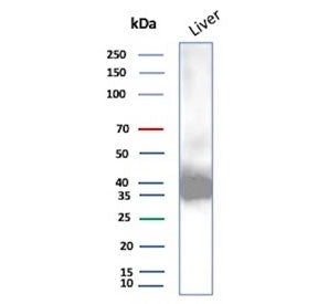 Western blot testing of human liver tissue lysate using AKR1C1 antibody (clone AKR1C1/9070). Predict