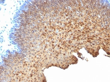 IHC analysis of formalin-fixed, paraffin-embedded human tonsil stained with Cytokeratin 10/13 antibo