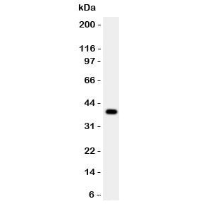 Western blot testing of Cathepsin B antibody and human HepG2 lysate. Molecular weight: 38-46 kDa depending on glycosylation level. An ~31 kDa form (propeptide removed) may be observed and may be further processed into an ~25 kDa heavy chain and ~5 kDa light chain.