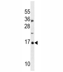 CDKN2A antibody western blot analysis in MDA-MB453 lysate.