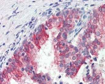 IHC testing of FFPE human prostate tissue with ROR1 antibody at 3ug/ml. Required HIER: steamed antig
