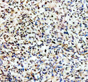 Immunohistochemical staining of TERF2IP using anti-TERF2IP antibody. TERF2IP was detected in a paraf