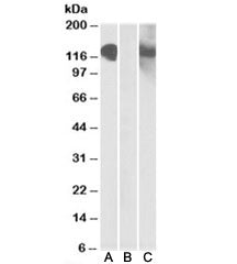Western blot testing of HEK293 lysate overexpressing CDH11-MYC with CDH11 antibody [1ug/ml] in Lane 