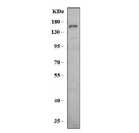 Western blot testing of rat liver tissue lysate with Tlr8 antibody. Expected molecular weight ~120 k