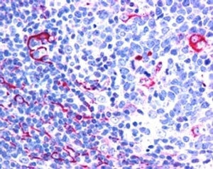 IHC testing of FFPE human tonsil with NET1 antibody at 2.5ug/ml. HIER: steamed with pH6 citrate buff