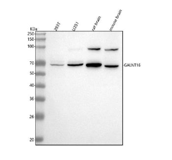 Western blot analysis of GALNT16 using anti-GALNT16 antibody. Lane 1: human 293T whole cell lysates,