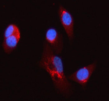 Immunofluorescent staining of SYCN using anti-SYCN antibody (red). SYCN was detected in an immunocyt