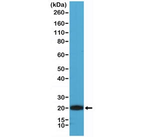 Western blot testing of human Jurkat cell lysate with recombinant CD3 epsilon antibody at 1:1000. Pr