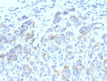 TRP1 / Tyrosinase-Related Protein-1 Antibody