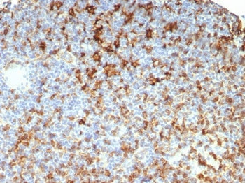 IHC staining of FFPE human lymph node tissue with HLA-DR antibody (clone HLA-DRB/7795R). HIER: boil 