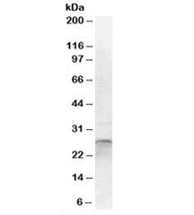 Western blot testing of human cerebellum lysate with OTUB2 antibody at 1ug/ml. Predicted/observed mo