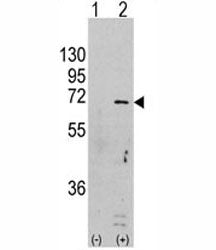 Western blot analysis of AMPK antibody and 293 cell lysate (2 ug/lane) either nontransfected (Lane 1) or transiently transfected with the PRKAA1 gene (2).