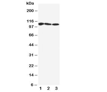 Western blot testing of SERCA1 ATPase antibody and Lane 1: rat skeletal muscle; 2: human PANC; 3: (h