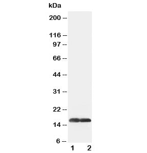 SOD1 Antibody Superoxide Dismutase 1