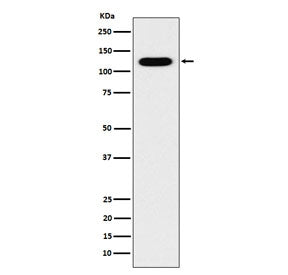Western blot testing of human fetal kidney lysate with Cadherin 16 antibody. Expected molecular weig