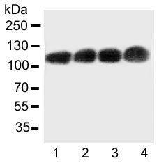 Western blot testing of CEA antibody and Lane 1: Recombinant human CEA protein 10ng; Lane 2: 5ng; 3: