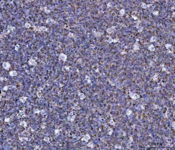 CCL15 Antibody / C-C motif chemokine 15 / MIP-5