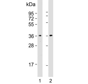 CAPZA1 Antibody