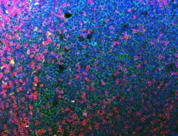 CD20 Antibody