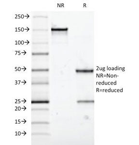 SDS-PAGE analysis of purified, BSA-free MUC5AC antibody (clone 58M1) as confirmation of integrity an