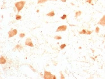 IHC testing of FFPE rat cerebellum with PGP9.5 antibody (clone UBCE-L1). Staining of formalin-fixed 