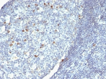 IgM Heavy Chain Antibody Cocktail