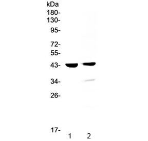 Western blot testing of 1) mouse testis and 2) rat testis lysate with Cathepsin D / CTSD antibody at