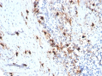 IHC staining of FFPE human tonsil tissue with recombinant TPSAB1 antibody (clone rTPSAB1/1963). HIER