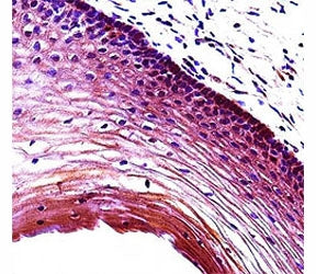 Puma antibody immunohistochemistry analysis in formalin fixed and paraffin embedded human cervix tis