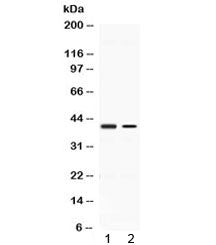 ABHD5 Antibody / CGI-58