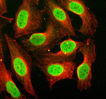 Immunofluorescent staining of CBX6 using anti-CBX6 antibody (green) and anti-Beta Tubulin antibody (