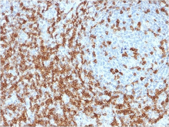 IHC staining of FFPE human tonsil with CD5 antibody (clone CD5/2419). Required HIER: boil tissue sec