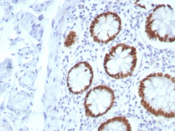 IHC staining of FFPE human colon tissue with SATB2 antibody (clone SATB2/8877R). HIER: boil tissue s