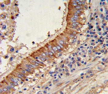 Major Vault Protein Antibody / MVP