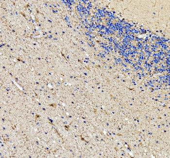 Immunohistochemical staining of ENO1 using anti-ENO1 antibody. ENO1 was detected in a paraffin-embed