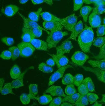 Immunofluorescent staining of FFPE human HepG2 cells with YTHDF2 antibody (green) and DAPI nuclear s