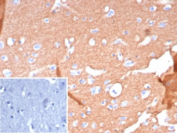 IHC staining of FFPE human brain tissue with recombinant CD171 antibody (clone L1CAM/9267R). Inset: 